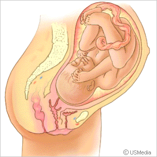 Bildergebnis für Bilder zu Schwangerschaft 9. Monat