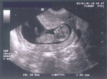 Baby 12 Schwangerschaftswoche