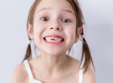 Kieferorthopädie braucht mein Kind eine Zahnspange
