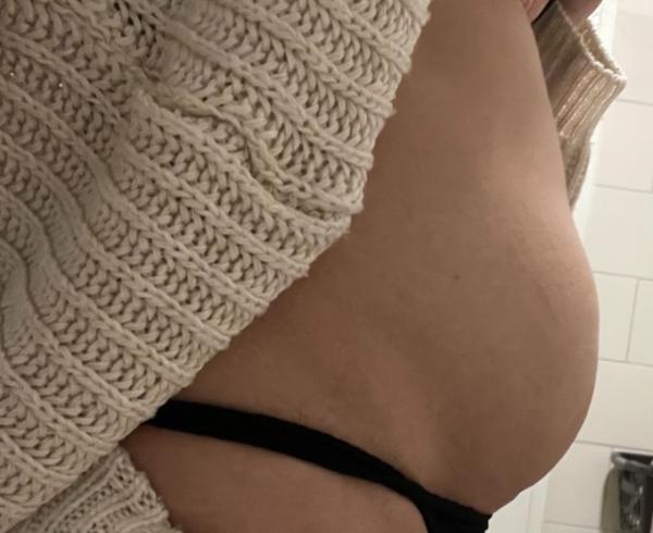 Bild zu Blähbauch oder schwanger? - Frauengesundheit