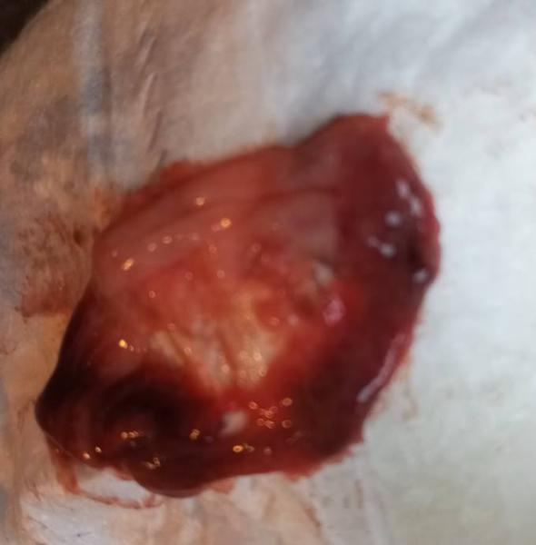 Bild zu Was kann das sein? TW Bild mit Blut - Frauengesundheit
