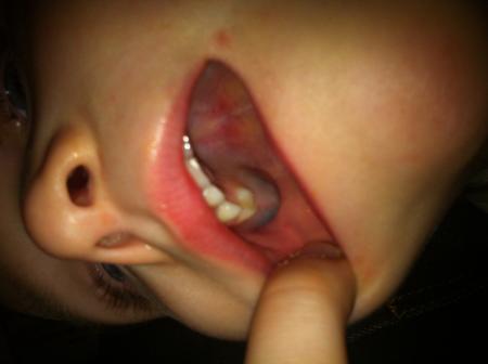 Bild zu 