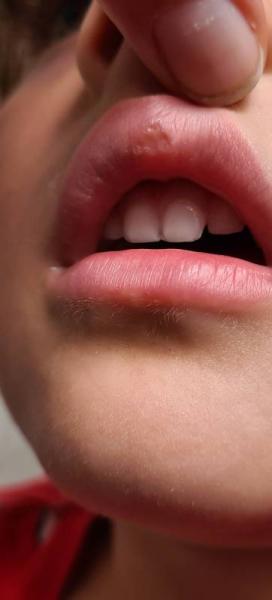 Bild zu Komische Stelle lippe - Rund ums Kleinkind - Tipps für Eltern