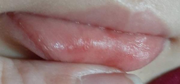 Bild zu Kleinkind 20 monate kleine blutflecken lippen - Rund ums Kleinkind - Tipps für Eltern