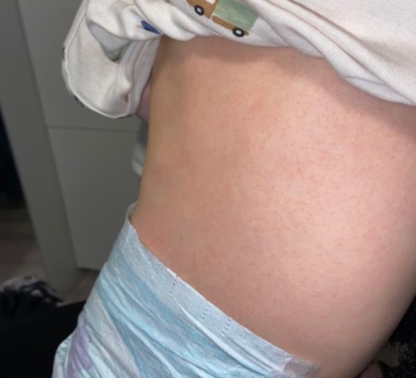 Bild zu Haut Sohn 18 Monate - Rund ums Kleinkind - Tipps für Eltern