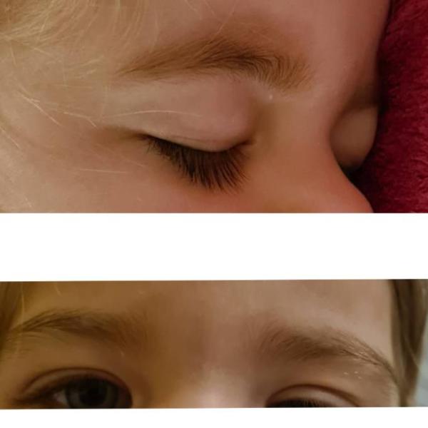 Bild zu Buschige Augenbrauen und Körperbehaaung - Rund ums Kleinkind - Tipps für Eltern