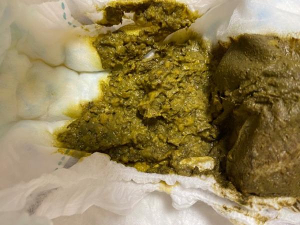 Bild zu Was sagt die Farbe des Stuhls aus? - Rund ums Kleinkind - Tipps für Eltern