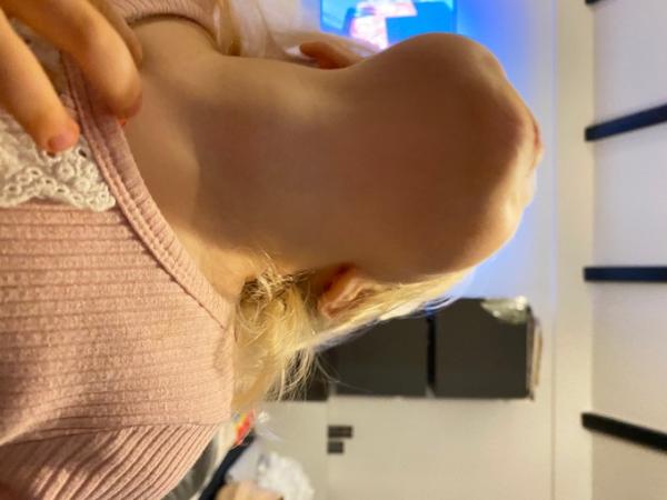 Bild zu Kropf bei Kleinkind / Schilddrüse vergrößert - Rund ums Kleinkind - Tipps für Eltern