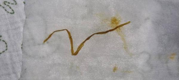 Bild zu Bandwurm? - Rund ums Kleinkind - Tipps für Eltern