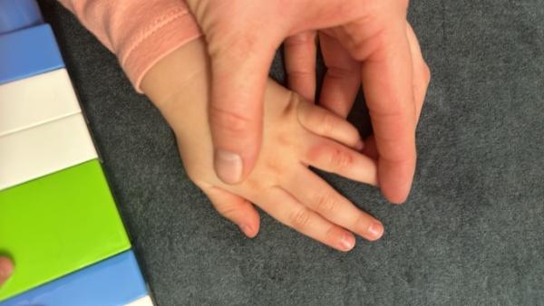 Bild zu Kleine wunde am finger - Rund ums Kleinkind - Tipps für Eltern
