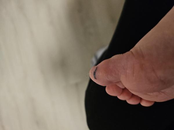 Bild zu Riss in der Hornhaut - Rund ums Kleinkind - Tipps für Eltern