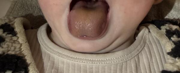 Bild zu Kennt das jemand!? Gelblich bräunliche Zunge… - Rund ums Kleinkind - Tipps für Eltern