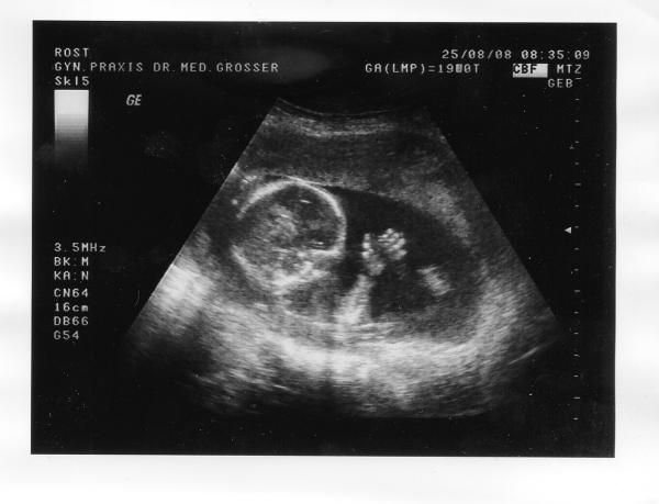 Bild zu Vornamen - Vornamen fürs Baby - Tipps und Ideen