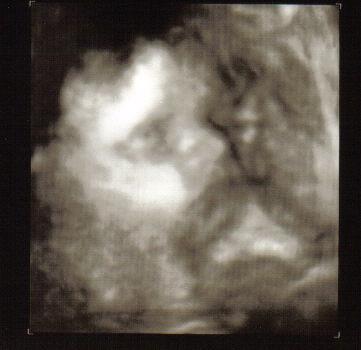 Bild zu @celestine, knopf und den Rest der "Mädels" :) - Vornamen fürs Baby - Tipps und Ideen