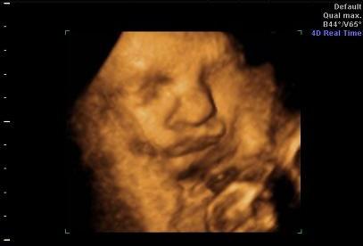 Bild zu ich seh dich, du mich nicht ... *ätsch* -- 4D US Bildchen - Vornamen fürs Baby - Tipps und Ideen