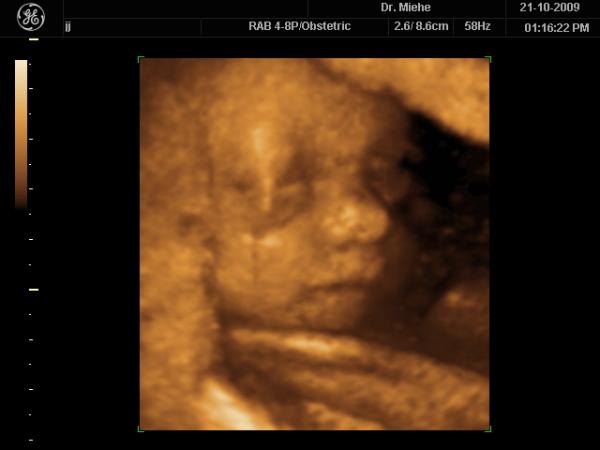 Bild zu französische Jungennamen ? - Vornamen fürs Baby - Tipps und Ideen