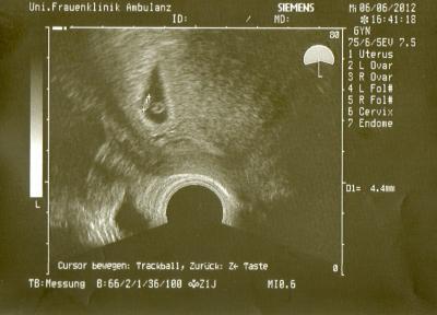 Bild zu also wenn das mal keine Nova ist *lächel - Vornamen fürs Baby - Tipps und Ideen
