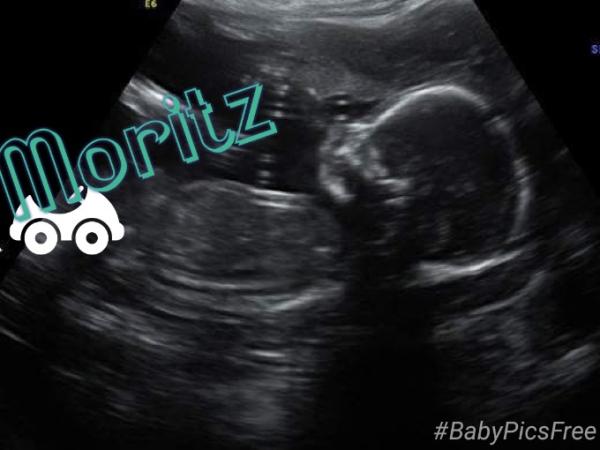 Bild zu Welcher Name passt besser zu den kleinen Mann? - Vornamen fürs Baby - Tipps und Ideen