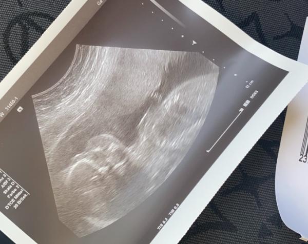 Bild zu hmmmm... - Vornamen fürs Baby - Tipps und Ideen