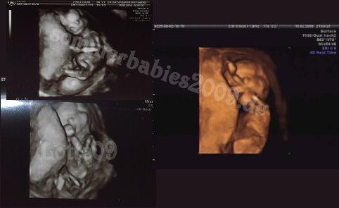 Bild zu 4D Bilder aus der 16.ssw - Schwanger - wer noch? Rund um die Schwangerschaft