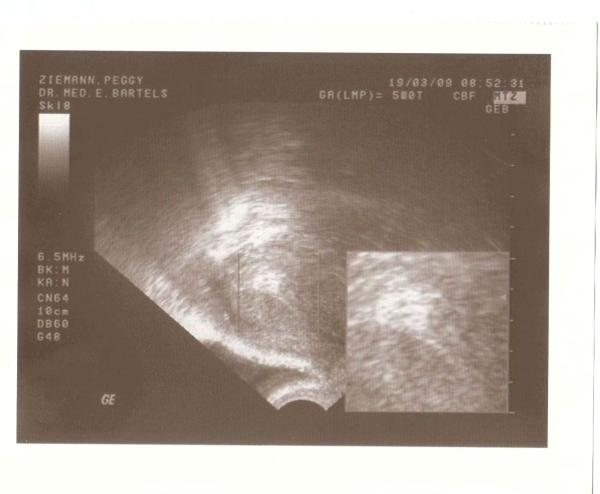 Bild zu Ultraschallbild!! - Schwanger - wer noch? Rund um die Schwangerschaft