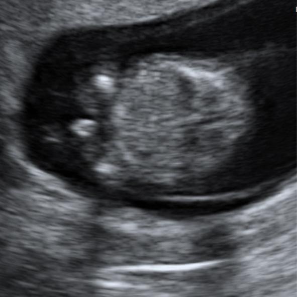 Bild zu Es werden noch Wetten angenommen;-) - Schwanger - wer noch? Rund um die Schwangerschaft