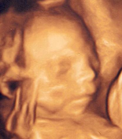 Bild zu ab wann nicht mehr auf dem rücken liegen??? - Schwanger - wer noch? Rund um die Schwangerschaft
