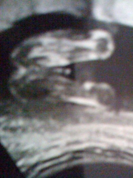 Bild zu US-Bilder Junge - Schwanger - wer noch? Rund um die Schwangerschaft