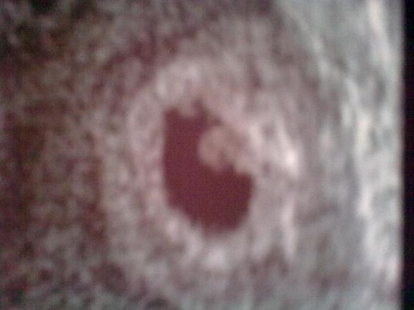 Bild zu 1. Foto - Schwanger - wer noch? Rund um die Schwangerschaft