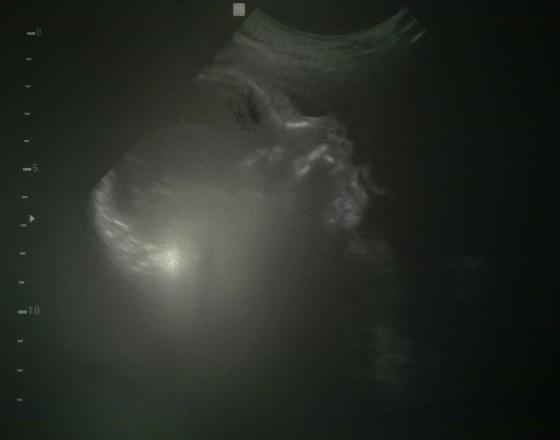 Bild zu Heute FA-Termin! Es ist alles super! - Schwanger - wer noch? Rund um die Schwangerschaft