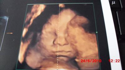 Bild zu Zurück von der Feindiagnostik..und soooo happy! :) - Schwanger - wer noch? Rund um die Schwangerschaft