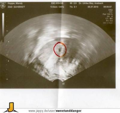Bild zu foto vom bauchzwerg - Schwanger - wer noch? Rund um die Schwangerschaft