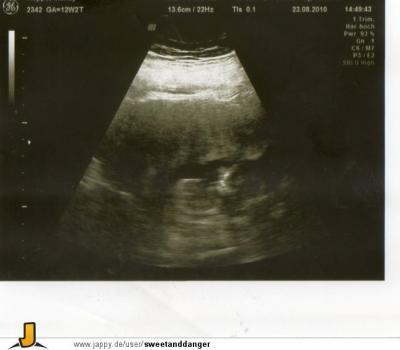 Bild zu BABYBILD 5,6cm leben - Schwanger - wer noch? Rund um die Schwangerschaft