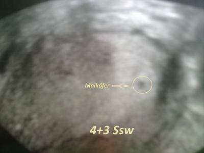 Bild zu ultraschallbild 4+3 ssw - Schwanger - wer noch? Rund um die Schwangerschaft
