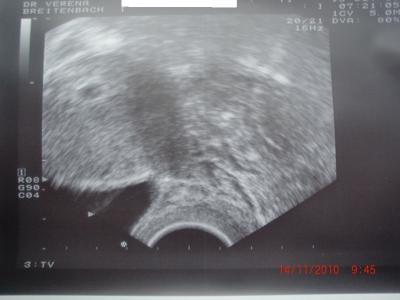 Bild zu Zurück vom FA+Bildchen :-) - Schwanger - wer noch? Rund um die Schwangerschaft