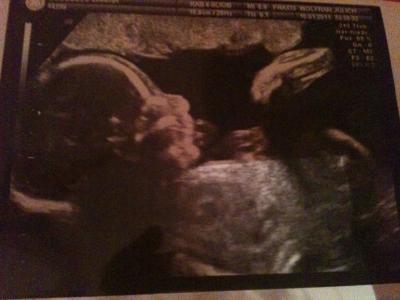 Bild zu Mein Krümelchen - Schwanger - wer noch? Rund um die Schwangerschaft