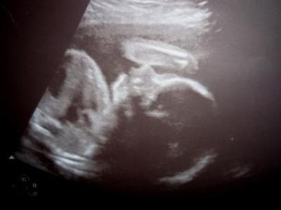 Bild zu us- Bild ssw 26 - Schwanger - wer noch? Rund um die Schwangerschaft