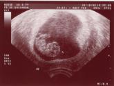 Bild zu Bin neu hier und wieder schwanger! - Schwanger - wer noch? Rund um die Schwangerschaft