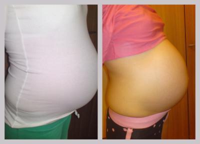 Bild zu bauch gesunken? - Schwanger - wer noch? Rund um die Schwangerschaft