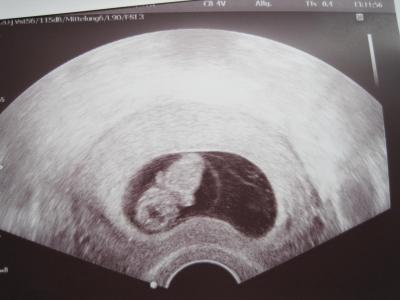 Bild zu welcome charlie brown *ggg* - Schwanger - wer noch? Rund um die Schwangerschaft