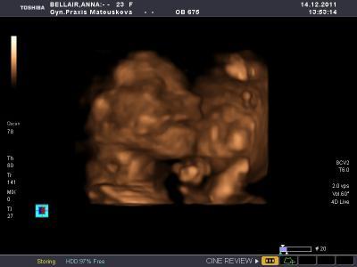 Bild zu 3D Foto unserer Maus - Schwanger - wer noch? Rund um die Schwangerschaft