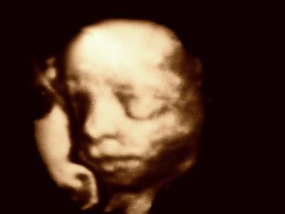 Bild zu Ähnlichkeit 3D/4D zu Baby-in-Echt wenns da ist? - Schwanger - wer noch? Rund um die Schwangerschaft