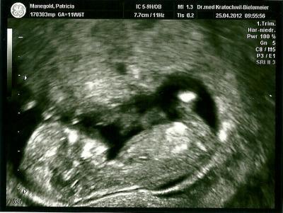 Bild zu HI ab wann 13. Woche???? - Schwanger - wer noch? Rund um die Schwangerschaft