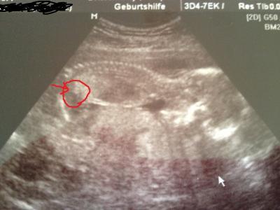 Bild zu Was meint ihr?? - Schwanger - wer noch? Rund um die Schwangerschaft