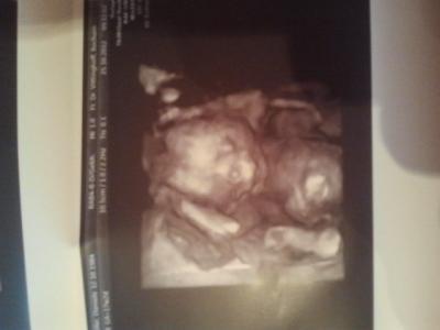 Bild zu Bilder 18. Ssw + Kinderwagen - Schwanger - wer noch? Rund um die Schwangerschaft