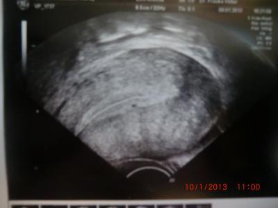 Bild zu Bitte mal gucken US Bild - Schwanger - wer noch? Rund um die Schwangerschaft
