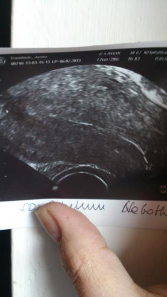 Bild zu BITTE ANSCHAUN!!! - Schwanger - wer noch? Rund um die Schwangerschaft