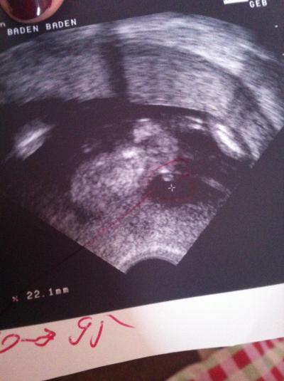 Bild zu Erkennt ihr was? - Schwanger - wer noch? Rund um die Schwangerschaft