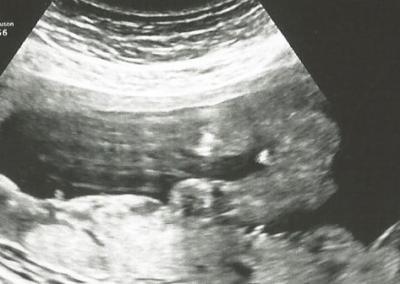 Bild zu 19. SSW Junge oder Mädchen? - Schwanger - wer noch? Rund um die Schwangerschaft