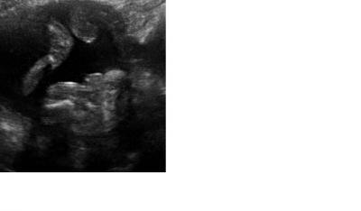 Bild zu Falsches Outing - Schwanger - wer noch? Rund um die Schwangerschaft